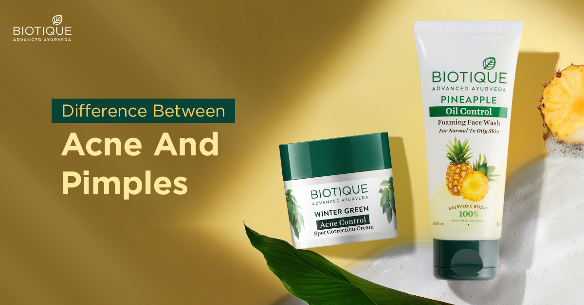 What is the difference between Acne and Pimples?